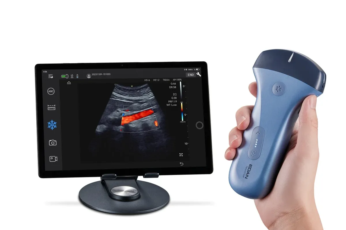 Edan NANO Ultrasound 2
