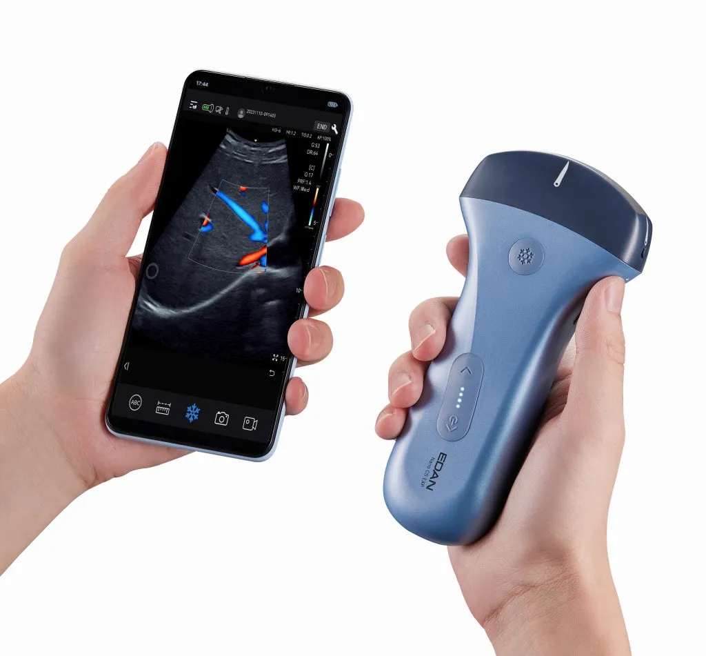Edan NANO Ultrasound 3