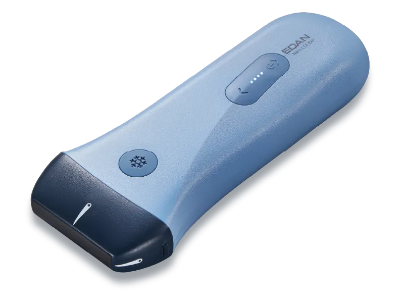 Edan NANO Ultrasound 4